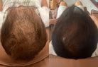 Botalab Deserticola Plus Shampoo, Conditioner & Oil Serum (3pc) - improve hair growth Botalab